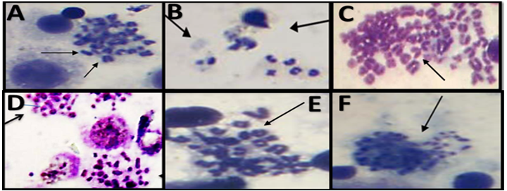 Showing the differences in types of chromosomal aberrations for all experimental groups (A) chromosome and chromatid breaks, (B) aneuploidy, (C) polyploid, (D) Analytic, (E) ring chromosomes, and (F) Fragmented chromosomes in metaphase of mice bone marrow cells (Giemsa stain, 1000X)